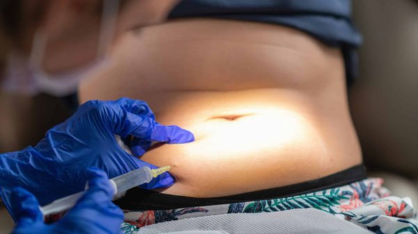 Hyperplasie adipeuse paradoxale : quand consulter votre médecin ?